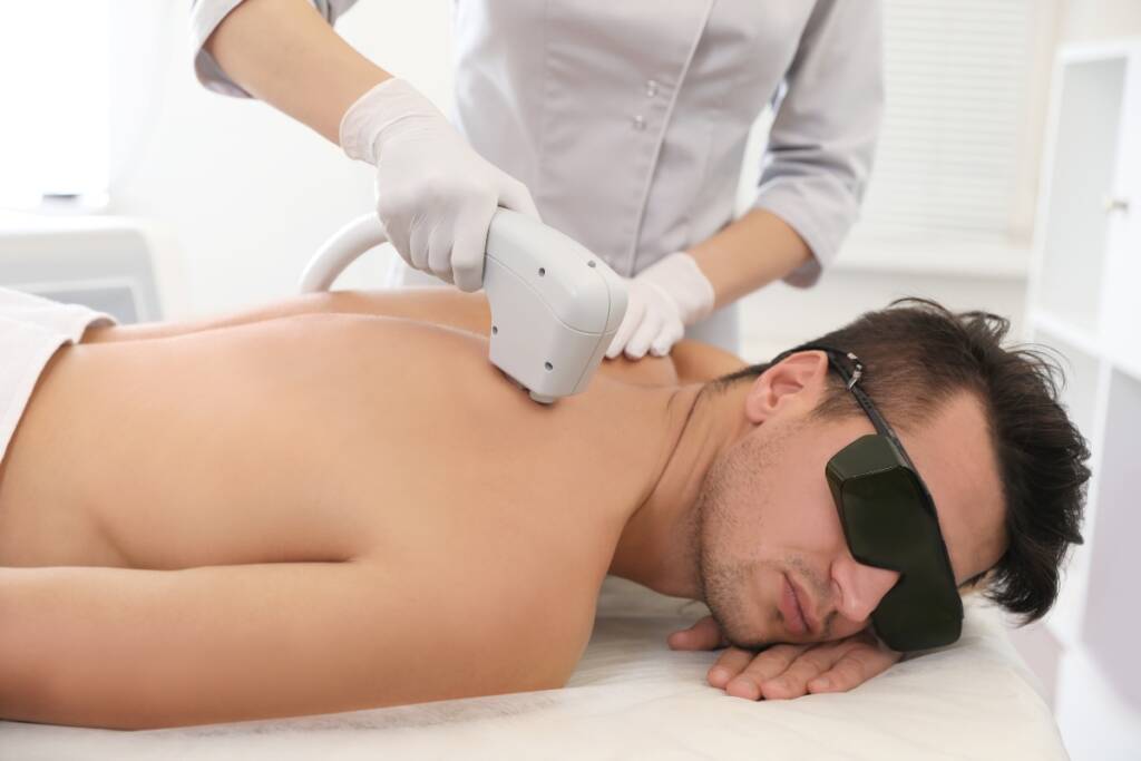 Man laser hair removal of the back